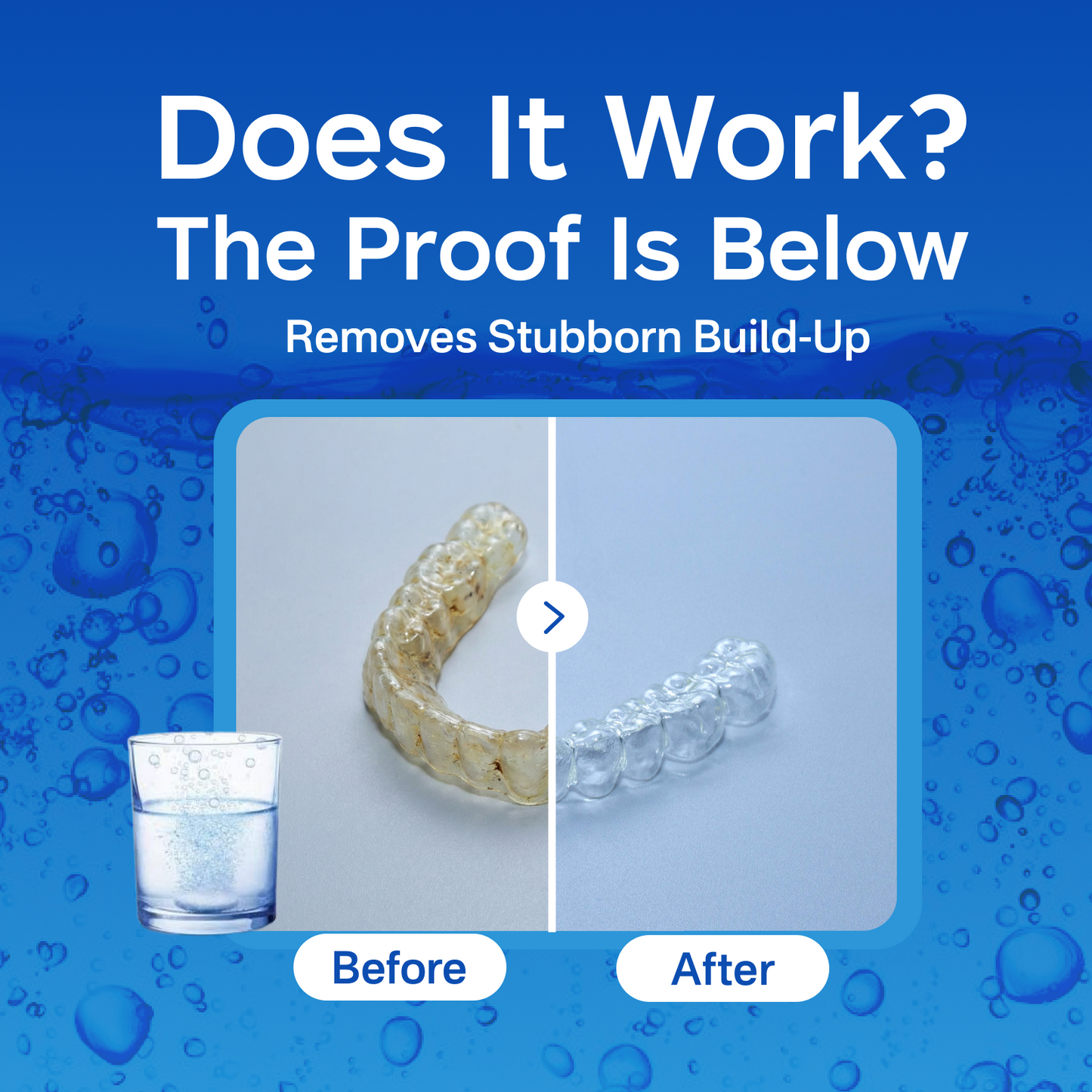 PICKZONE Extra Strength Retainer Cleaner Tablets - Advanced Stain & Odor Eliminator