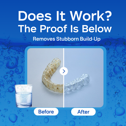 PICKZONE Extra Strength Retainer Cleaner Tablets - Advanced Stain & Odor Eliminator